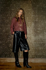 Zara Bermuda Shorts Clearance