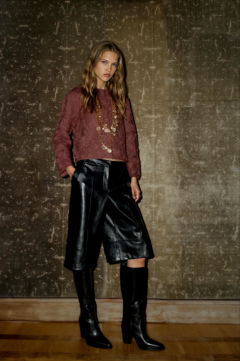 Zara Bermuda Shorts Clearance